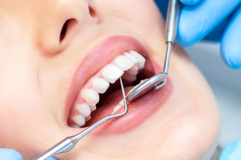 Understanding Dental Bridges and How They Work